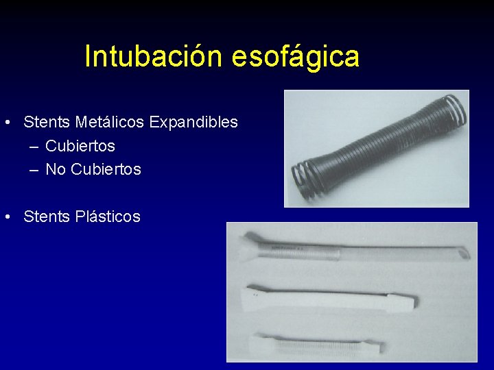 Intubación esofágica • Stents Metálicos Expandibles – Cubiertos – No Cubiertos • Stents Plásticos Intubación esofágica • Stents Metálicos Expandibles – Cubiertos – No Cubiertos • Stents Plásticos