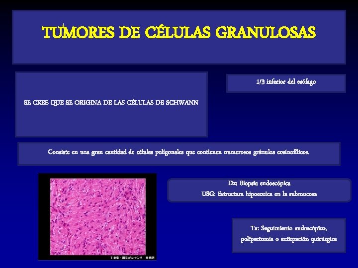 TUMORES DE CÉLULAS GRANULOSAS 1/3 inferior del esófago SE CREE QUE SE ORIGINA DE TUMORES DE CÉLULAS GRANULOSAS 1/3 inferior del esófago SE CREE QUE SE ORIGINA DE