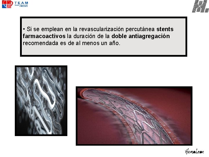  • Si se emplean en la revascularización percutánea stents farmacoactivos la duración de