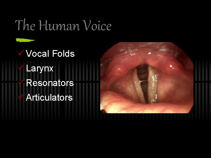 The Human Voice ü Vocal Folds ü Larynx ü Resonators ü Articulators 