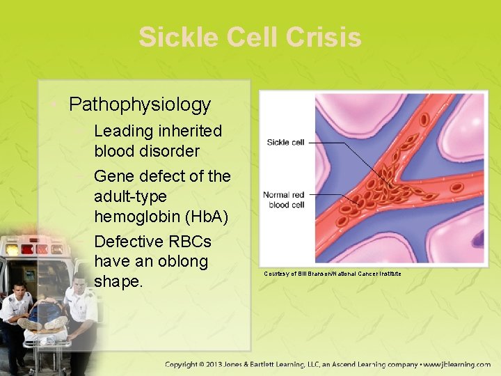 Sickle Cell Crisis • Pathophysiology − Leading inherited blood disorder − Gene defect of