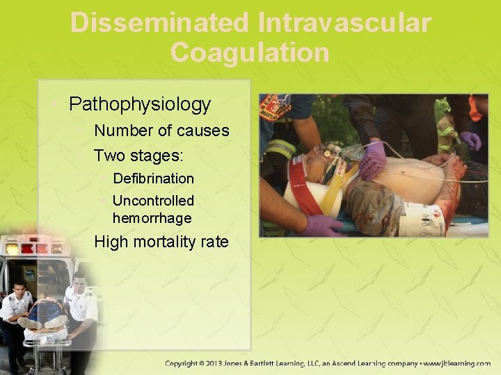 Disseminated Intravascular Coagulation • Pathophysiology − Number of causes − Two stages: • Defibrination