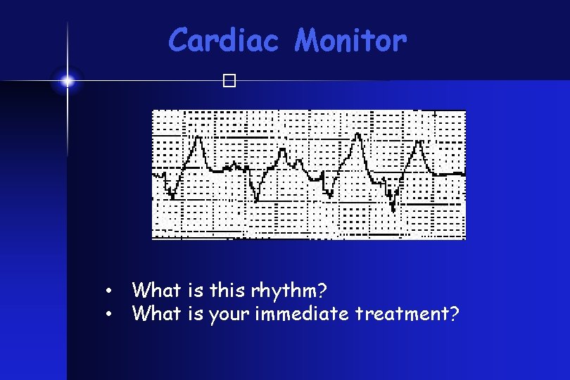 Cardiac Monitor � • What is this rhythm? • What is your immediate treatment?