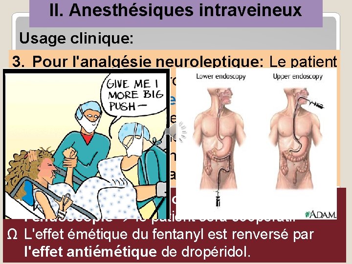 II. Anesthésiques intraveineux Usage clinique: 3. Pour l'analgésie neuroleptique: Le patient est sous sédation