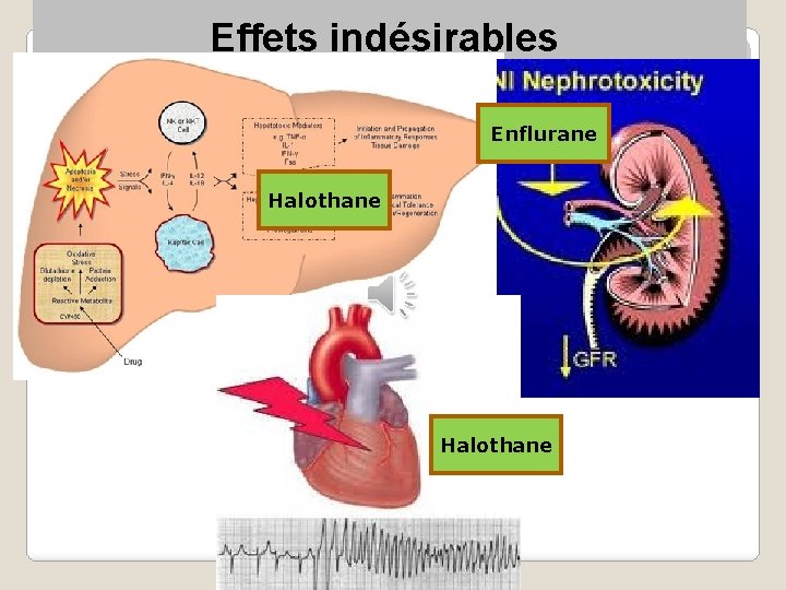 Effets indésirables Enflurane Halothane 