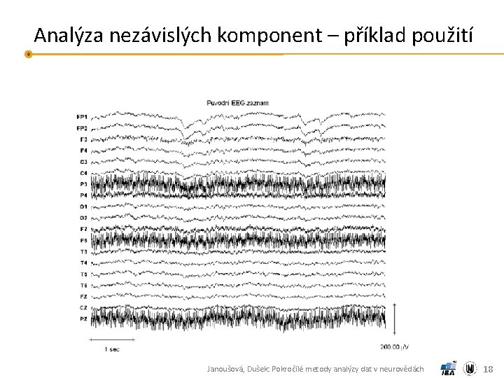 Analýza nezávislých komponent – příklad použití Janoušová, Dušek: Pokročilé metody analýzy dat v neurovědách