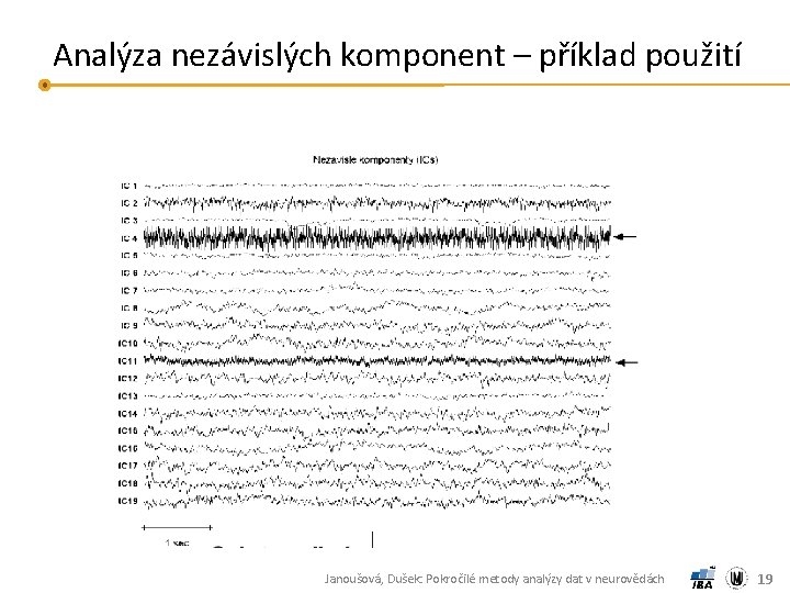 Analýza nezávislých komponent – příklad použití Janoušová, Dušek: Pokročilé metody analýzy dat v neurovědách