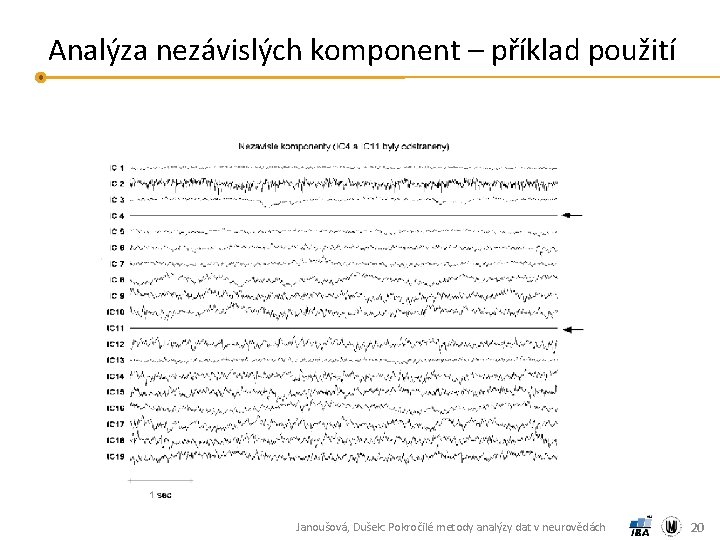 Analýza nezávislých komponent – příklad použití Janoušová, Dušek: Pokročilé metody analýzy dat v neurovědách