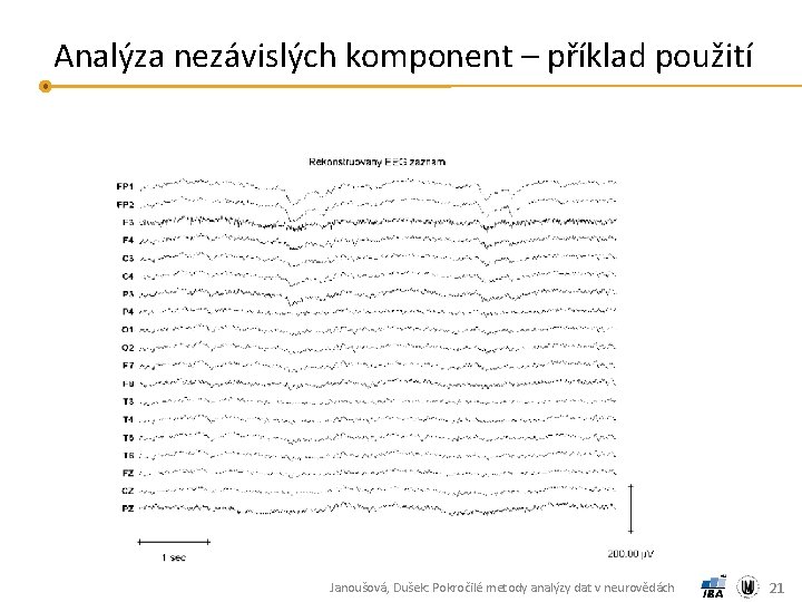 Analýza nezávislých komponent – příklad použití Janoušová, Dušek: Pokročilé metody analýzy dat v neurovědách