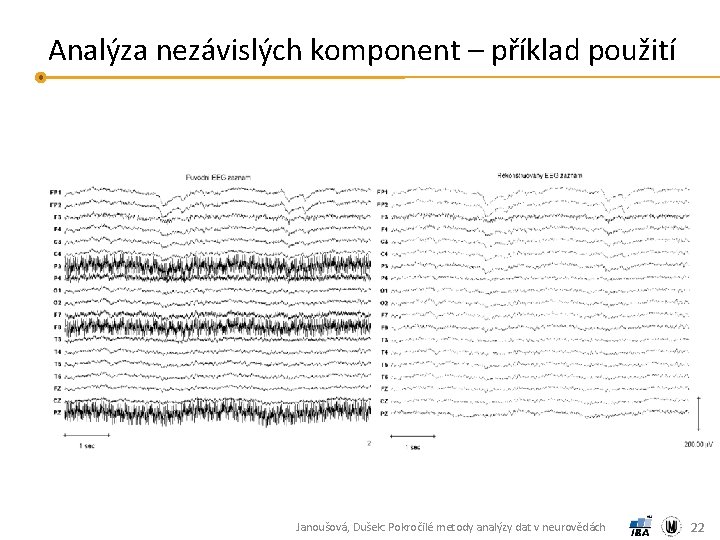 Analýza nezávislých komponent – příklad použití Janoušová, Dušek: Pokročilé metody analýzy dat v neurovědách