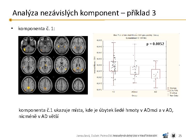 Analýza nezávislých komponent – příklad 3 • komponenta č. 1: p = 0. 0052