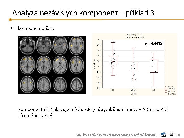 Analýza nezávislých komponent – příklad 3 • komponenta č. 2: p = 0. 0089