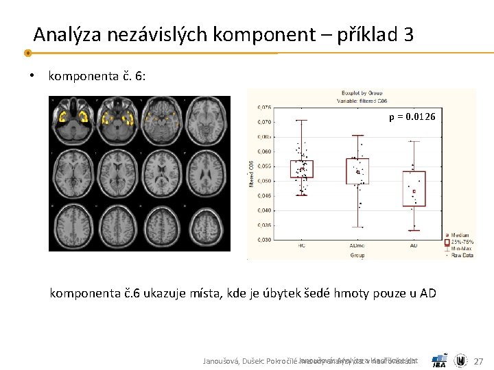 Analýza nezávislých komponent – příklad 3 • komponenta č. 6: p = 0. 0126