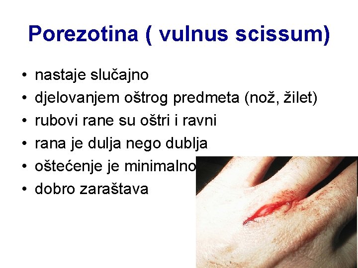 Porezotina ( vulnus scissum) • • • nastaje slučajno djelovanjem oštrog predmeta (nož, žilet)