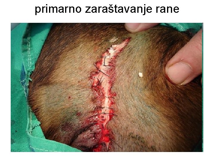 primarno zaraštavanje rane 