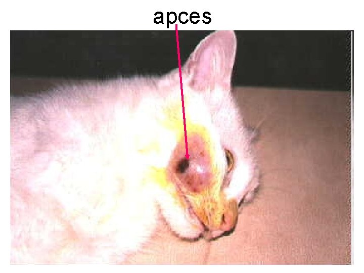 apces 