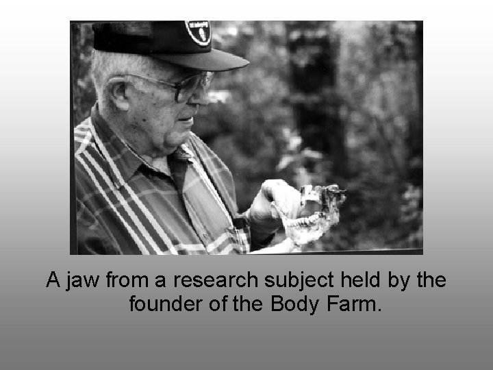 A jaw from a research subject held by the founder of the Body Farm.