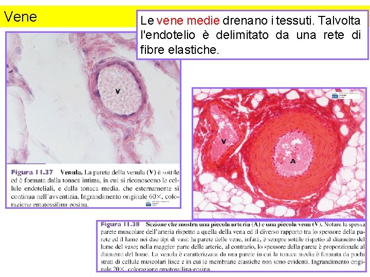 Vene Le vene medie drenano i tessuti. Talvolta l'endotelio è delimitato da una rete