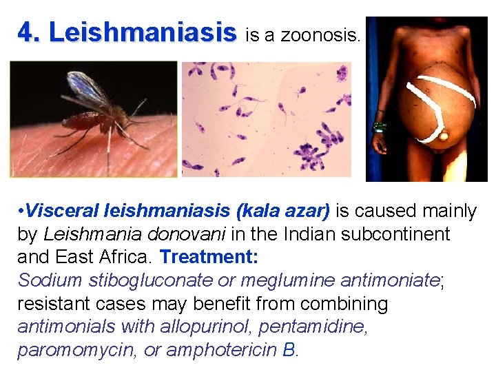 4. Leishmaniasis is a zoonosis. • Visceral leishmaniasis (kala azar) is caused mainly by