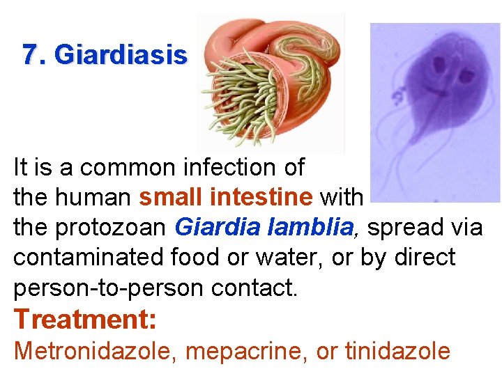 7. Giardiasis It is a common infection of the human small intestine with the