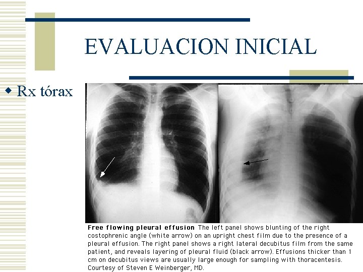 EVALUACION INICIAL w Rx tórax EVALUACION INICIAL w Rx tórax