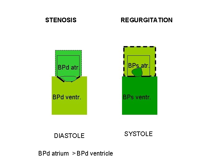 STENOSIS REGURGITATION BPd atr. BPs atr. BPd ventr. BPs ventr. DIASTOLE SYSTOLE BPd atrium