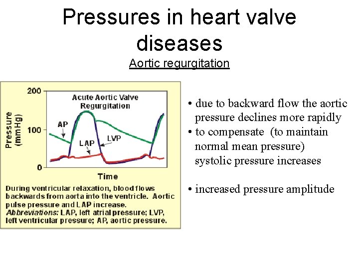 Pressures in heart valve diseases Aortic regurgitation • due to backward flow the aortic