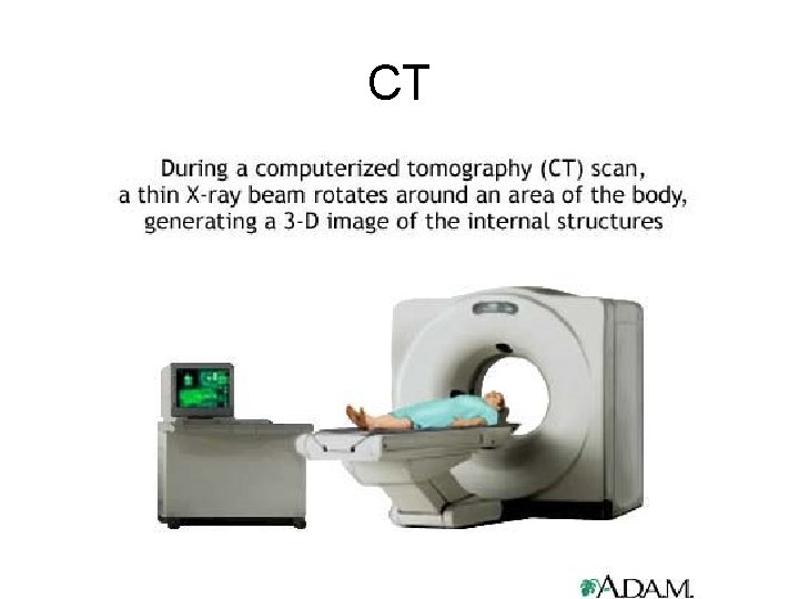 CT 