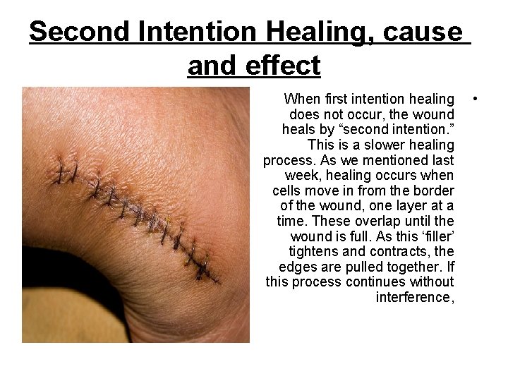 Second Intention Healing, cause and effect When first intention healing • does not occur,