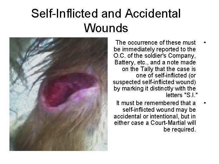 Self-Inflicted and Accidental Wounds The occurrence of these must • be immediately reported to