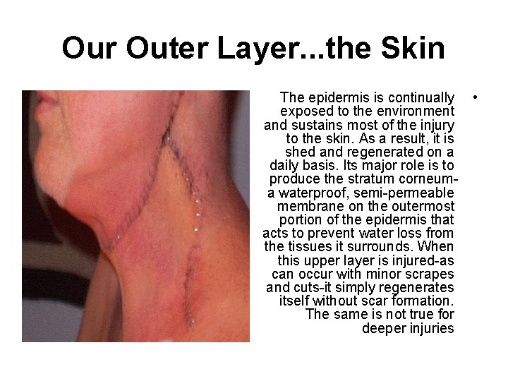 Our Outer Layer. . . the Skin The epidermis is continually • exposed to