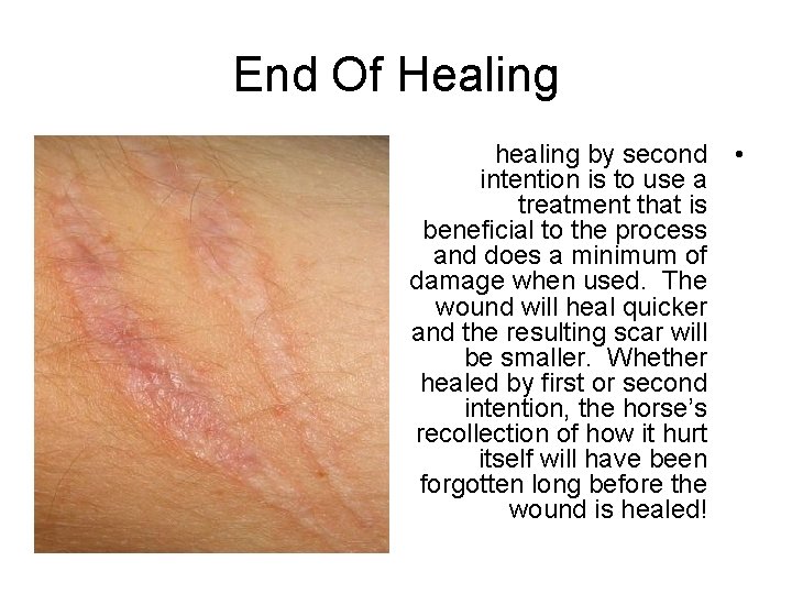 End Of Healing healing by second • intention is to use a treatment that