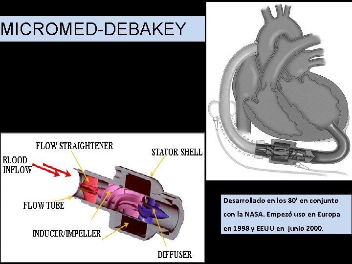 MICROMED-DEBAKEY Desarrollado en los 80’ en conjunto con la NASA. Empezó uso en Europa