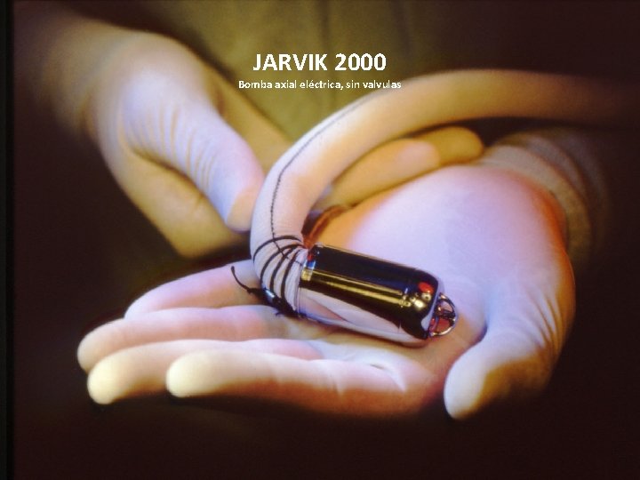 JARVIK 2000 Bomba axial eléctrica, sin valvulas 
