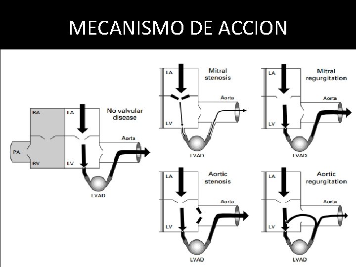 MECANISMO DE ACCION 