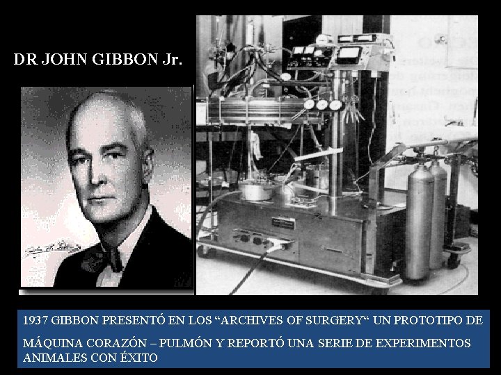 DR JOHN GIBBON Jr. 1937 GIBBON PRESENTÓ EN LOS “ARCHIVES OF SURGERY“ UN PROTOTIPO