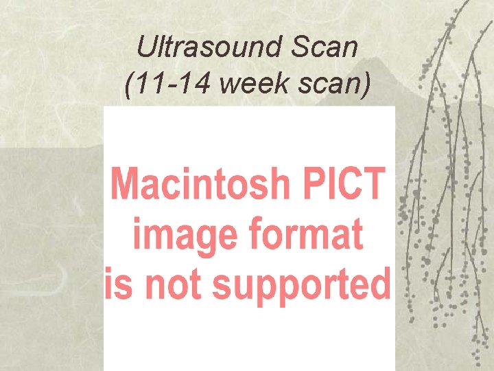 Ultrasound Scan (11 -14 week scan) 