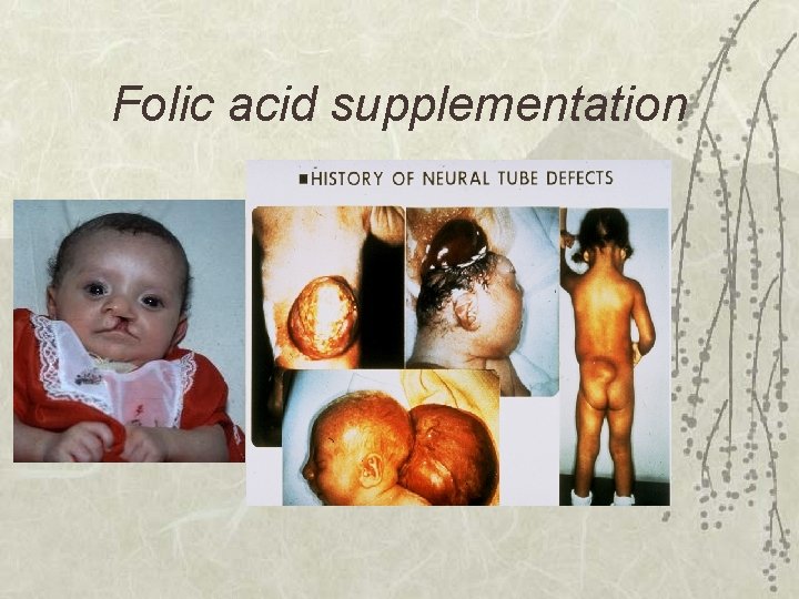 Folic acid supplementation 