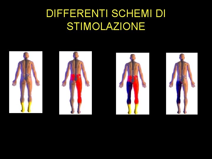 DIFFERENTI SCHEMI DI STIMOLAZIONE DIFFERENTI SCHEMI DI STIMOLAZIONE