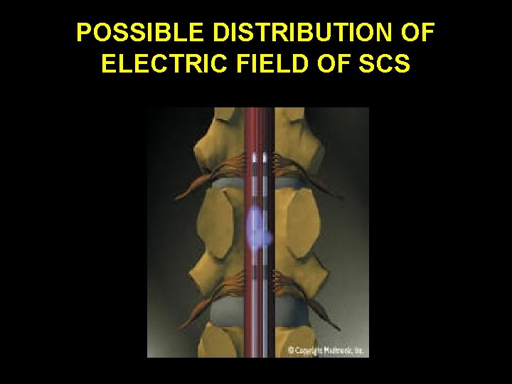 POSSIBLE DISTRIBUTION OF ELECTRIC FIELD OF SCS POSSIBLE DISTRIBUTION OF ELECTRIC FIELD OF SCS