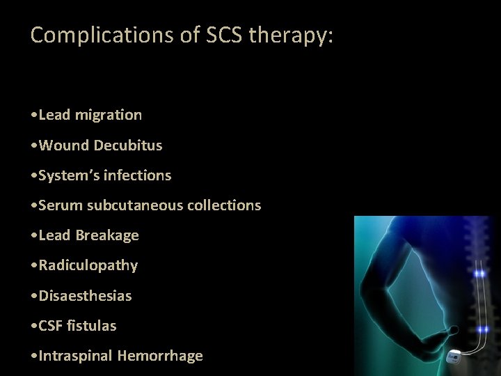 Complications of SCS therapy: • Lead migration • Wound Decubitus • System’s infections • Complications of SCS therapy: • Lead migration • Wound Decubitus • System’s infections •