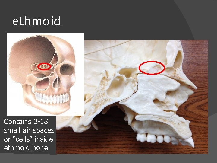 ethmoid Contains 3 -18 small air spaces or “cells” inside ethmoid bone 