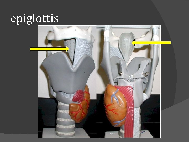 epiglottis 