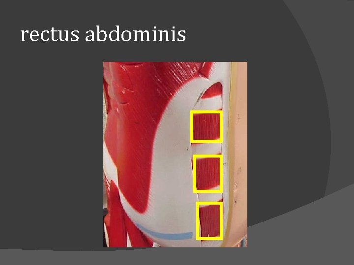 rectus abdominis 