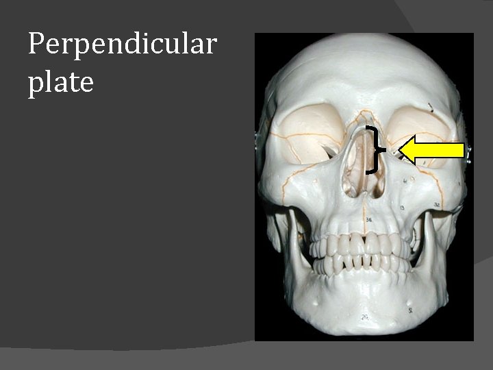 Perpendicular plate 