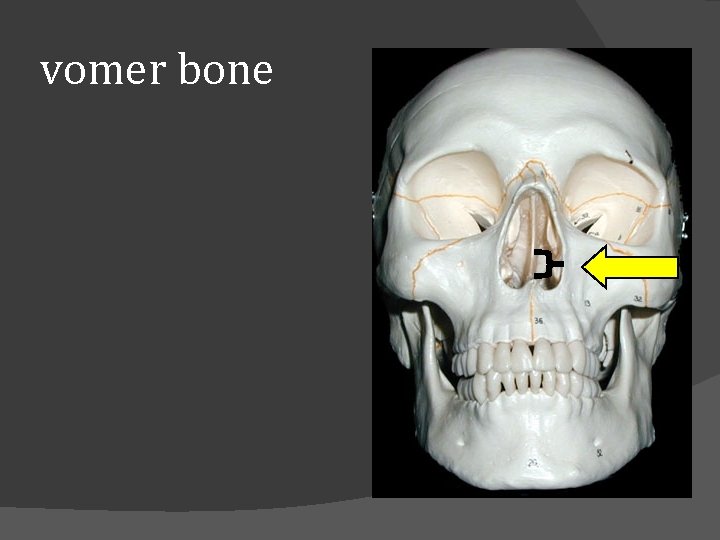 vomer bone 