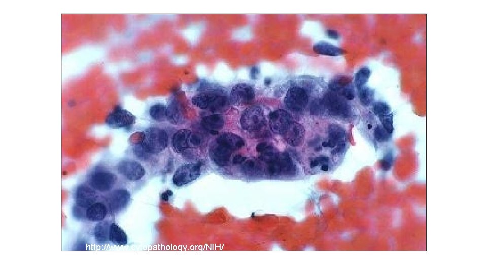 http: //www. cytopathology. org/NIH/ 