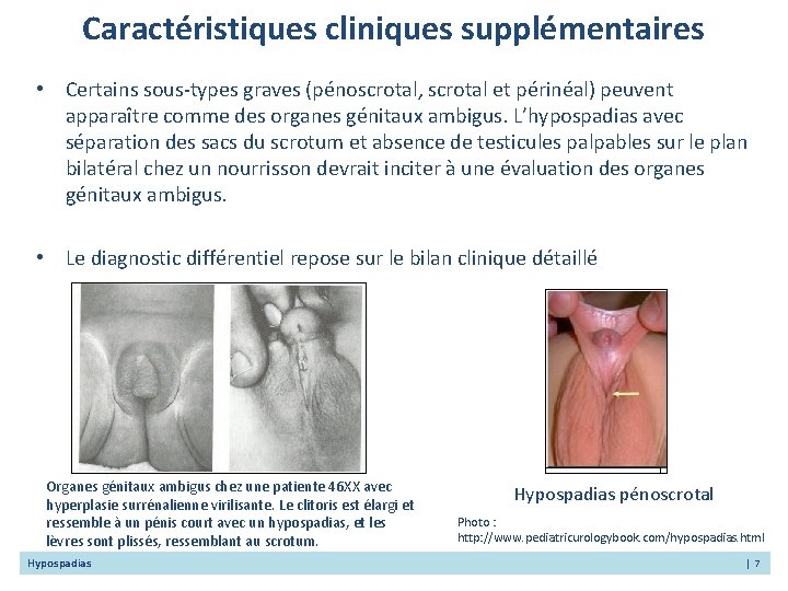 Logos Hypospadias Clause De Nonresponsabilit Les Rsultats Et