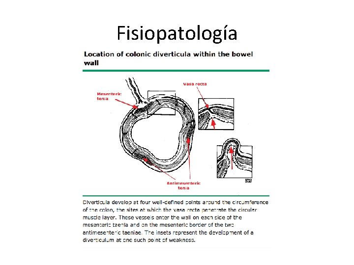 Fisiopatología 