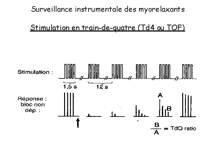 Surveillance instrumentale des myorelaxants Stimulation en train-de-quatre (Td 4 ou TOF) 